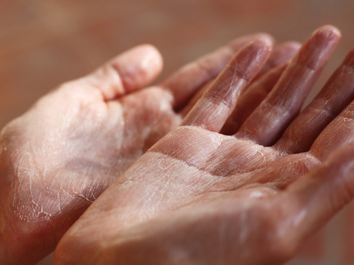 "Self-care is not a luxury, but a priority"