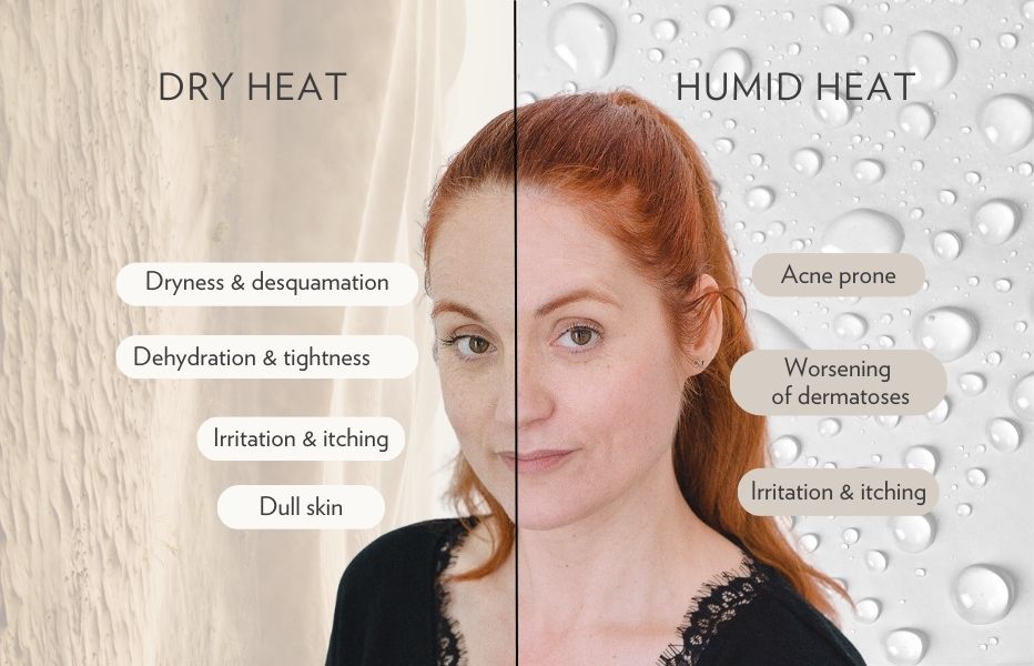 Protect your skin from the heat: Key tips