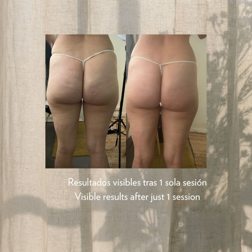 DUO SILHOUETTE CORPORELLE : SILK RENEW + SILHOUETTE