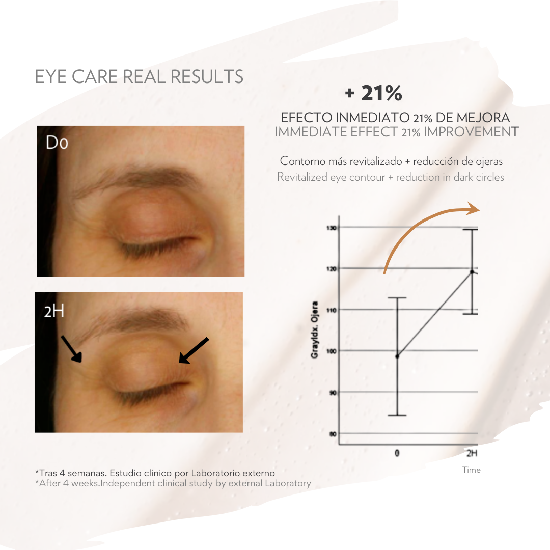SOIN CONTOUR DES YEUX | Soin hydratant, réduit les cernes et les poches. | 20 ml.